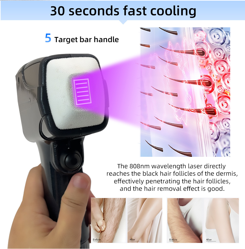 New Style Portable 808 NM Wave - Industrial Laser Hair Removal Machine ulasan dan harga